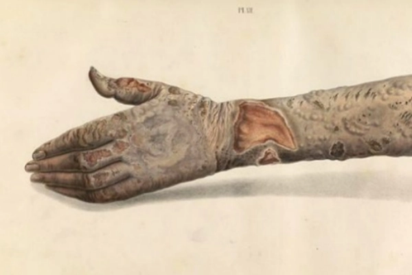 Unbelievable!  These Are the 10 Most Painful Conditions on Earth (#5 Still Exists in the US!)